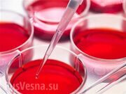 Российские ученые разработали технологию клеточной терапии диабета